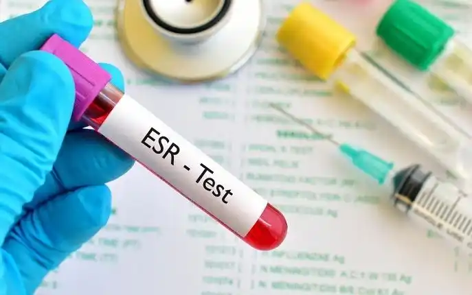 راهنما و روش ها و نکات کلیدی برای شناسایی زود هنگام سرطان با آزمایش خون