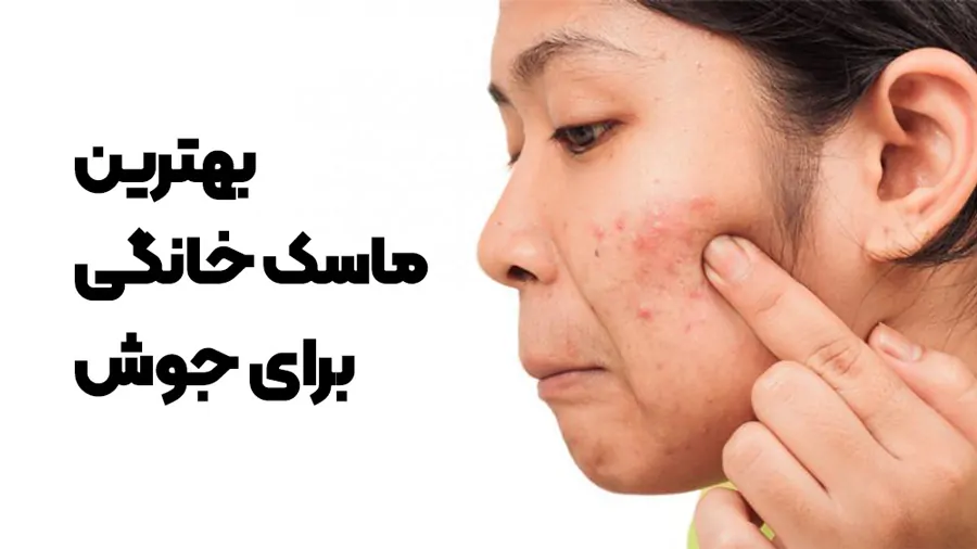 بهترین ماسک خانگی برای جوش صورت چرب