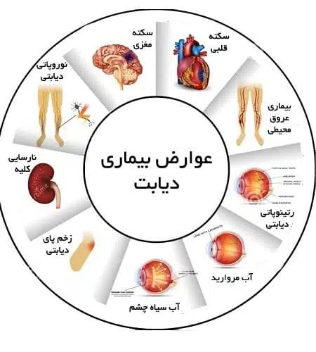 دیابت بیماری است که حدود ۴۲۲ میلیون نفر در سراسر جهان را به خود درگیر کرده است. این آماری است که از سوی سازمان بهداشت جهانی اعلام شده است. همچنین براساس اطلاعات این سازمان، سالانه ۱.۵ میلیون نفر به دلیل ابتلا به قند خون بالا جان خود را از دست می‌دهند.