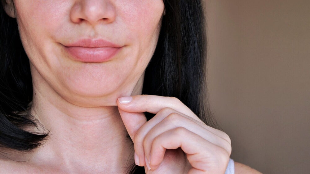 عارضه پوست نازک صورت در زبان انگلیسی با عنوان Thin Face Skin شناخته می‌شود. در مجموع، اصطلاح Thin Skin به نازکی پوست اطلاق می‌شود.