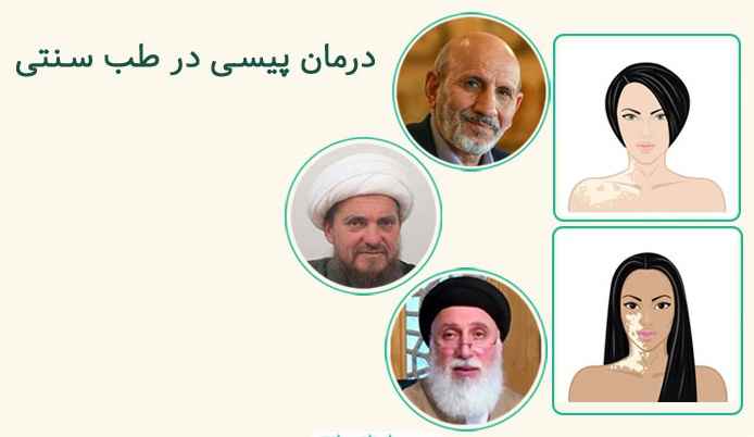  راهنمای جامع درمان پیسی در طب سنتی