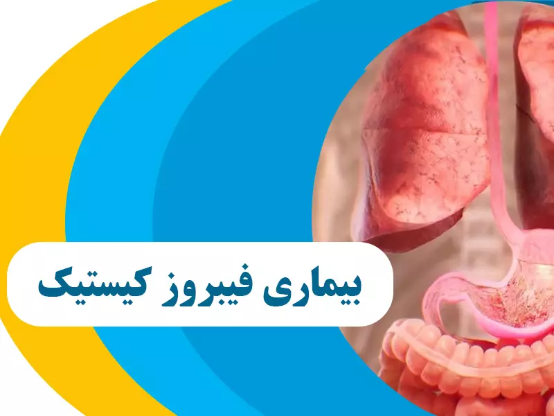  فیبروز سیستیک چیست و چگونه تشخیص داده می شود؟