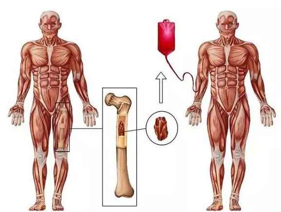 اهدا سلول‌های بنیادی خونساز 